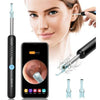 Smart Ear Wax Remover: Clearer, Safer Ear Care - Aquan Express